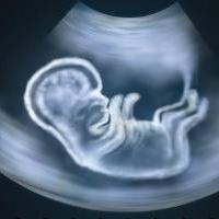 Který den ultrazvuk ukazuje těhotenství?