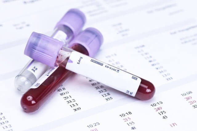 Jak projít krevní test na sterilitu?